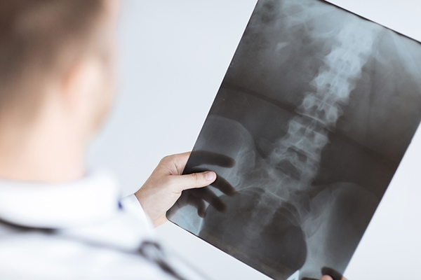 A Category Management Approach to Spine Care Can Help Healthcare Organizations Develop Increased Value, Deeper Partnerships